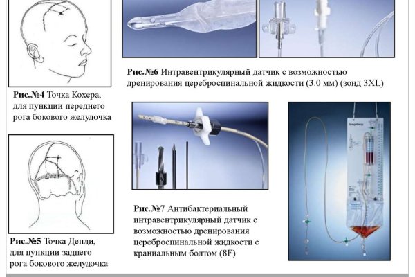 Bs gl ссылка